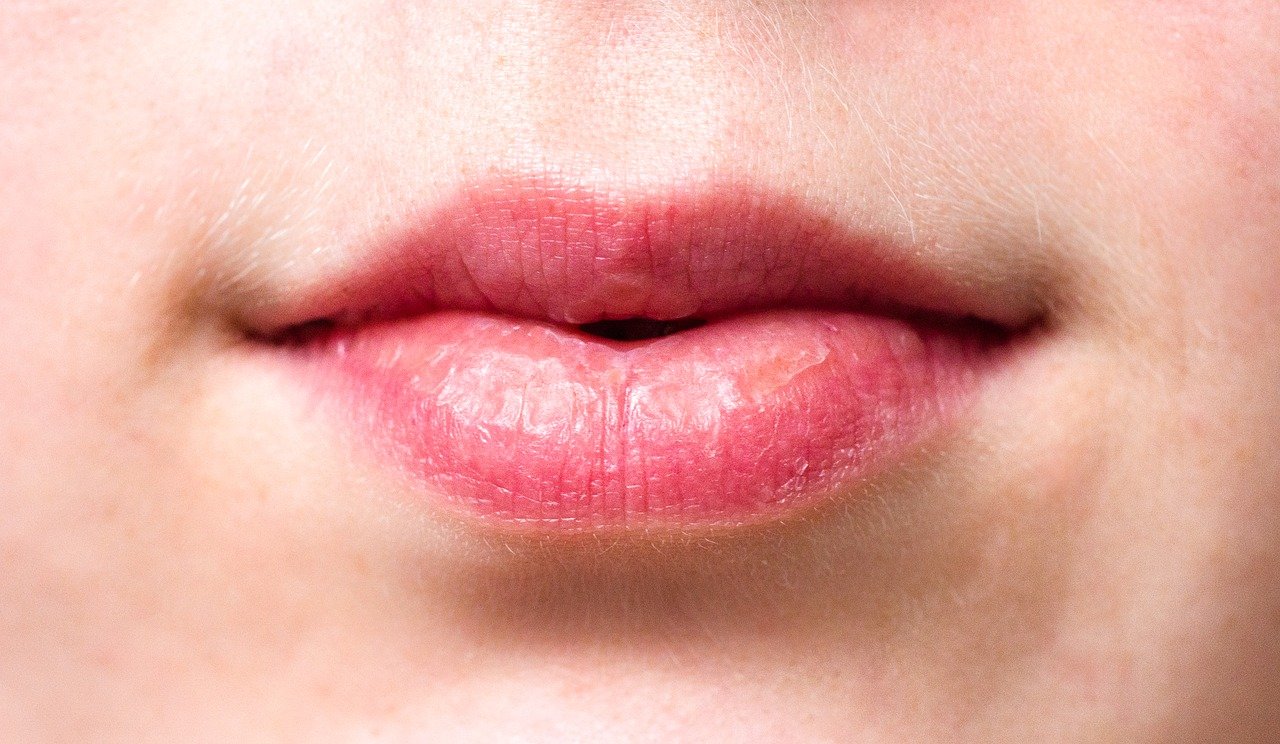 Why Your Lips Are Chapped (and Natural Ways to Heal Them)